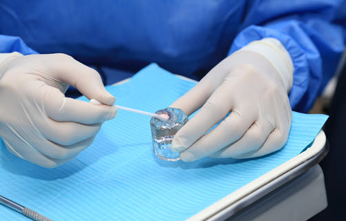 Fluoride Treatments