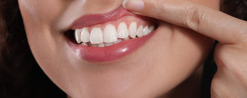 Gum Health