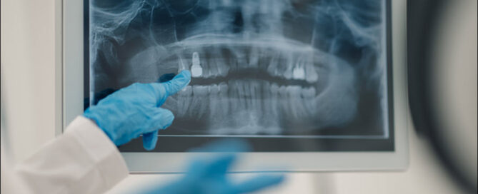 Digital X-Rays