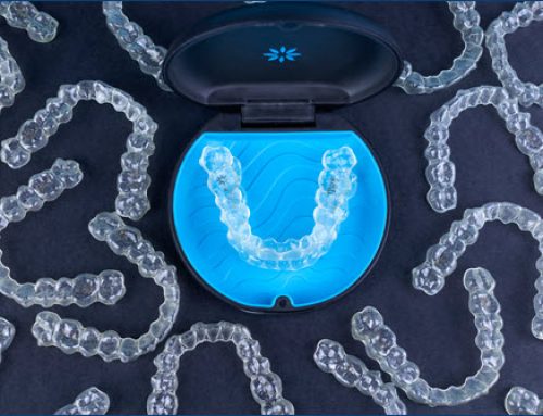 Why Invisalign is Popular for Correcting Teeth Alignment